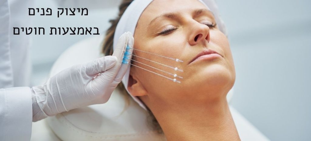 מיצוק פנים באמצעות חוטים