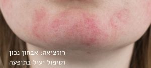 רוזציאה - rosacea