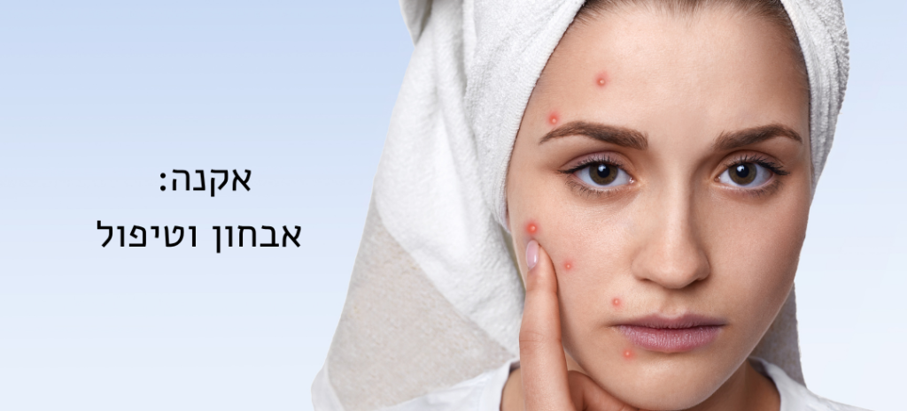 סוגי אקנה: אבחון וטיפול