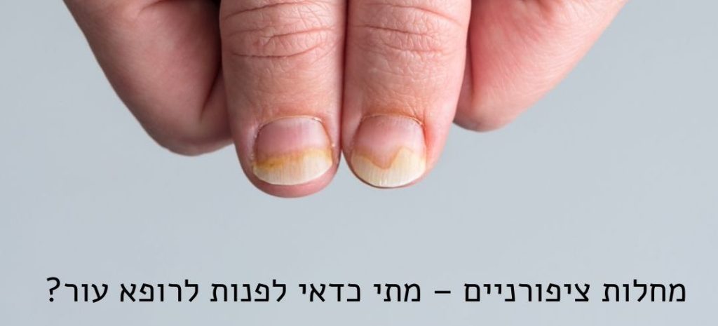 מחלות ציפורניים