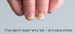 מחלות ציפורניים