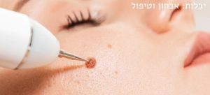 יבלות: אבחון נכון וטיפול יעיל בגידולים עוריים שכיחים