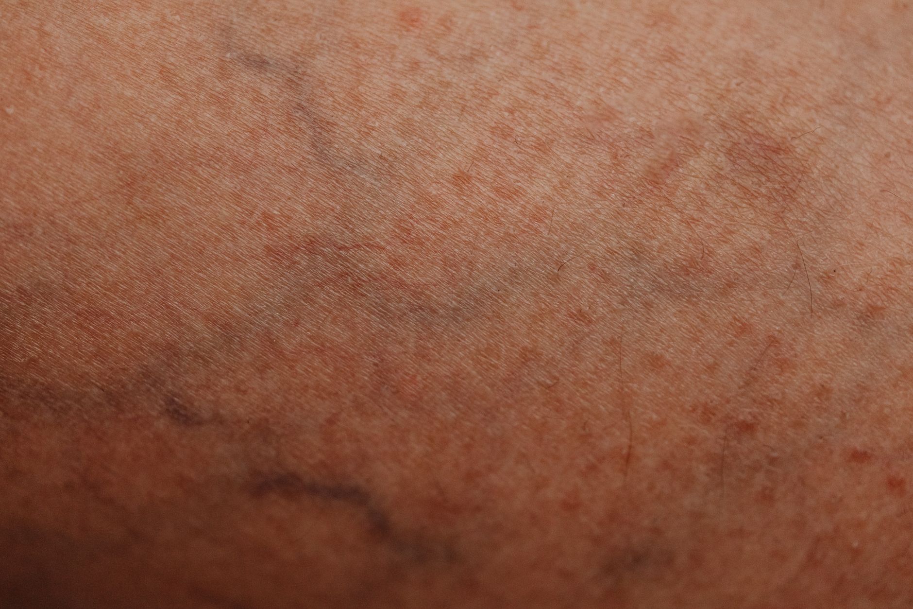 תקריב של מרקם העור – תמונת המחשה
